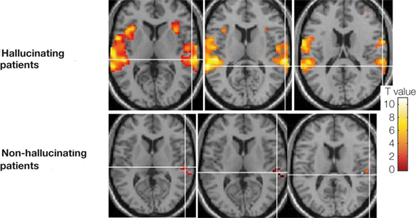 Ventral Temporal Lobe