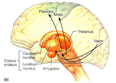 thalamic syndrome